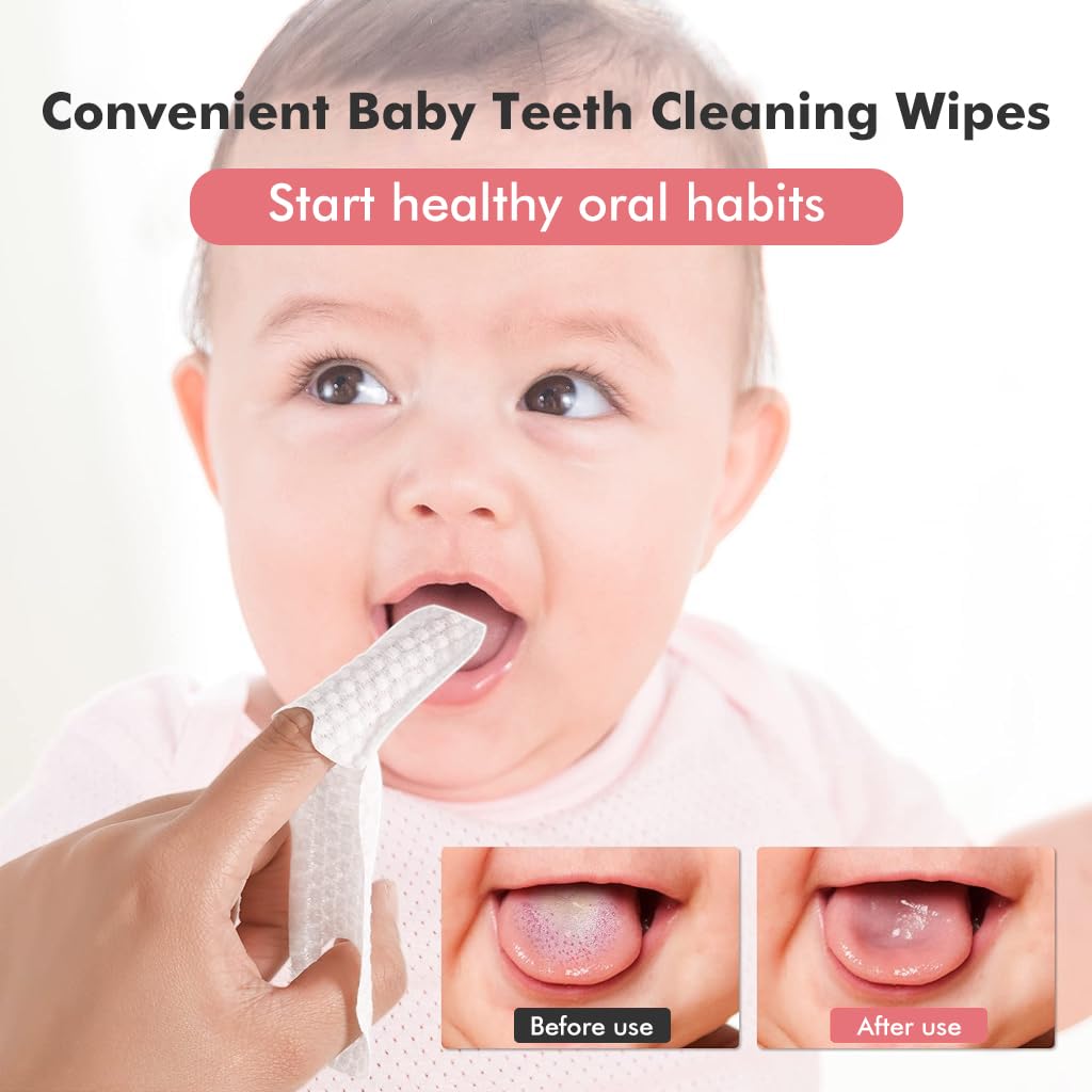 SNOWIE SOFT 30Pcs Baby Teeth Cleaning Wipes Gum Friendly Soft Baby Use Dental Wipes Finger Cot Tooth Tissues Dry & Wet Use Baby Oral Cleaning Tissues for 0-24 Months SNOWIE SOFT 30Pcs Baby Teeth Cleaning Wipes Gum Friendly Soft Baby Use Dental Wipes Finger Cot Tooth Tissues Dry & Wet Use Baby Oral Cleaning Tissues for 0-24 Months